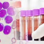 Leukemia cells and scientist testing in laboratory
