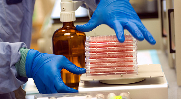 A lab technician's hands are pictured holding a tray of samples. A laboratory bottle is visible in the background.