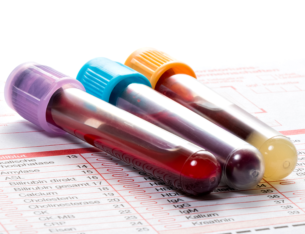 Three blood samples in vials are on a laboratory form.