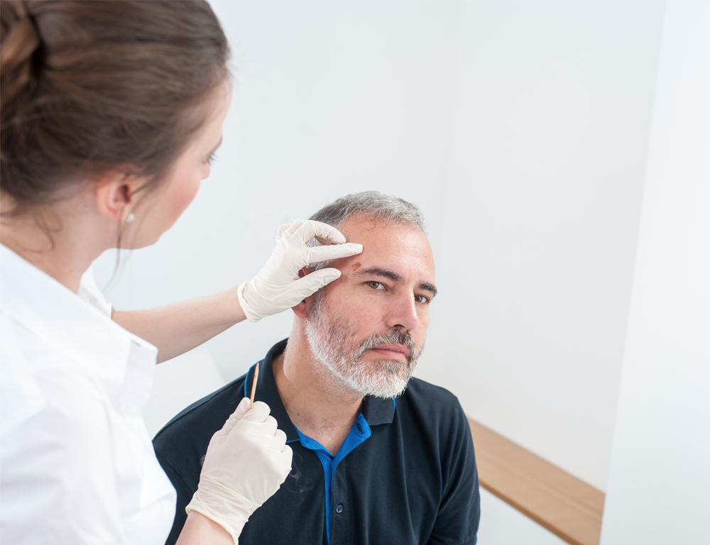 A medical provider in a white shirt and wearing white rubber gloves inspects a growth on a male patient's forehead.