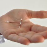 A close-up of an IUD, being held in the palm of a hand.