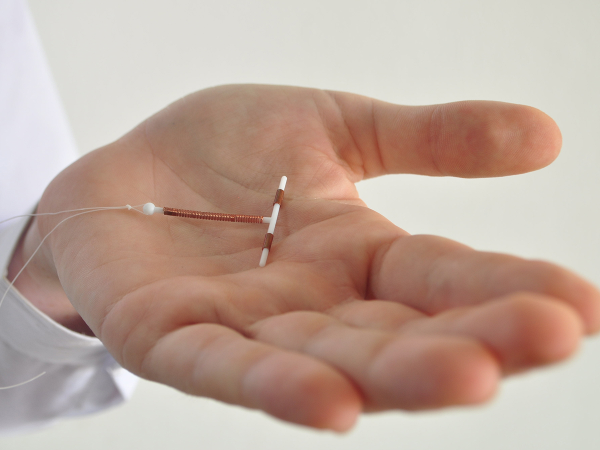 A close-up of an IUD, being held in the palm of a hand.
