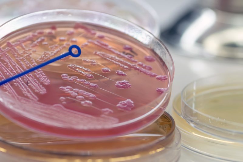 A close-up of a petri dish with pink liquid and some other matter. Other petri dishes are in the background.