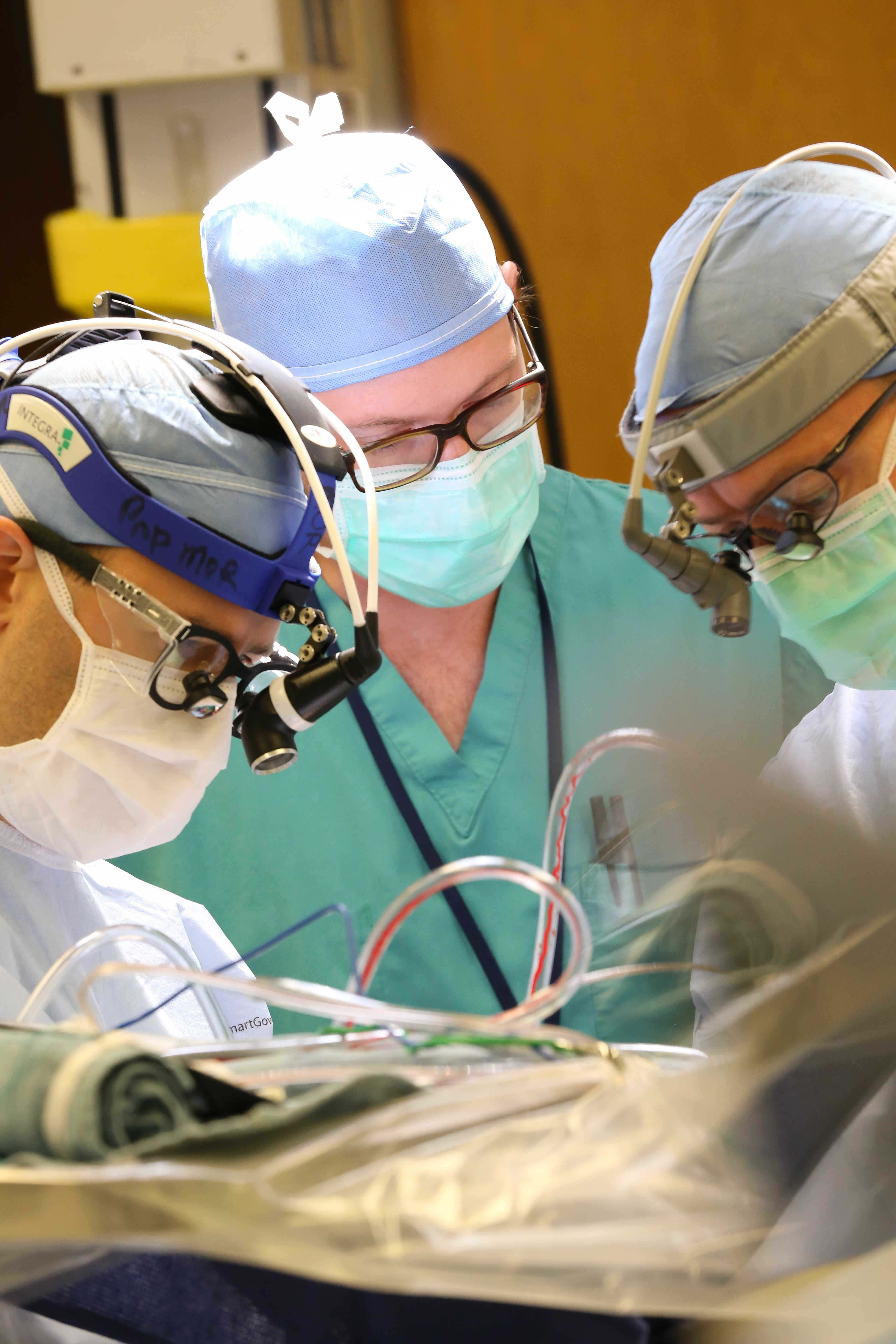 Three male neurosurgeons perform brain surgery. All three are wearing scrubs, surgical caps, surgical masks and glasses. The surgeons on the right and left have head-mounted neurosurgery magnifier loupes. Blood is visible through plastic tubing connected to a patient who is lying on the table. The patient is covered with a plastic sheet.