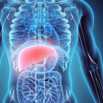 Ask Us Anything About¦ Liver Cancer