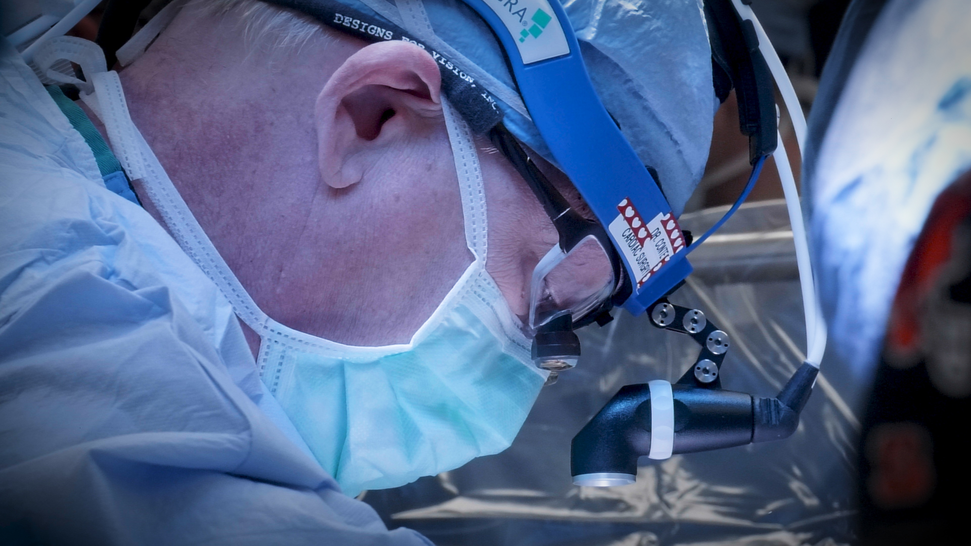 Dr. John Conte, program director of cardiac surgery at Penn State Milton S. Hershey Medical Center, performs heart surgery in the operating room. He is wearing a surgical cap, a grown, a mask that covers his mouth and small goggles fitted with lenses and lights to aid in the procedure.