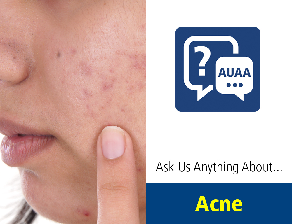 Ask Us Anything About... Acne