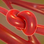 A stylized image of a knotted blood vessel.