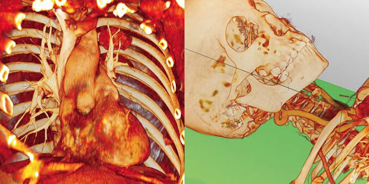 An anatomical image of the heart and chest is seen, with an anatomical image of a skull and upper skeleton next to it.