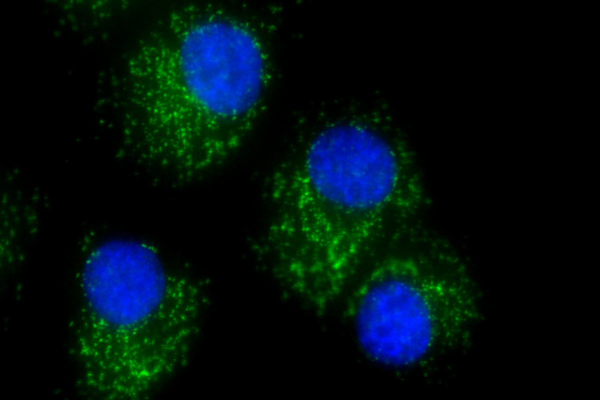 Fluorescent images of ovarian cancer cells