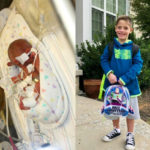 Two images side-by-side show Kai Parke. The photo on the left is Parke as a newborn with tubes and wires protruding from his blankets. On the right, Parke grins at the camera, standing on a walkway in front of a hedgerow. He holds a Buzz Lightyear backpack and wears sneakers.