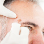 Gloved hands inspect a spot above the right eye on a man's face.