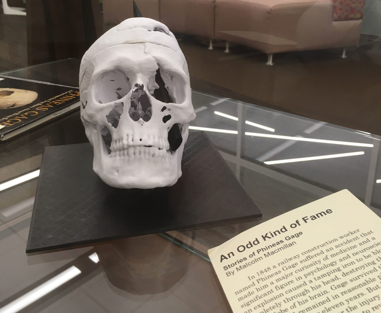A 3D-printed replica of the skull of Phineas Gage and a copy of an 1850s manuscript about him are seen in a display case.