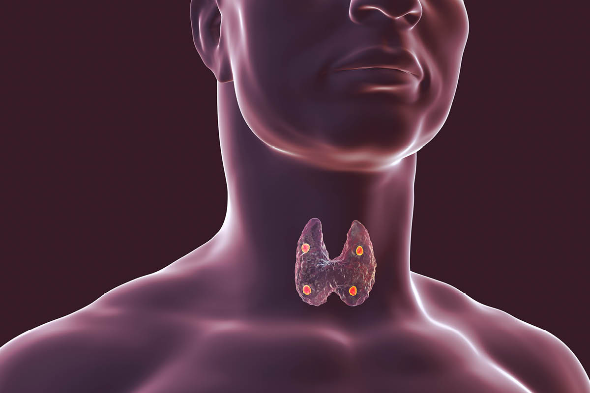 A cumber generated image showing the thyroid