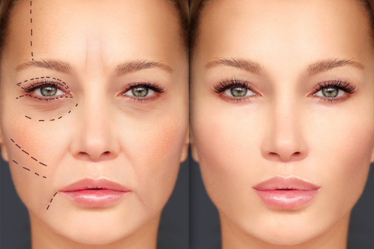 Side-by-side depictions of a woman's face. The image on the left has lines drawn on it.