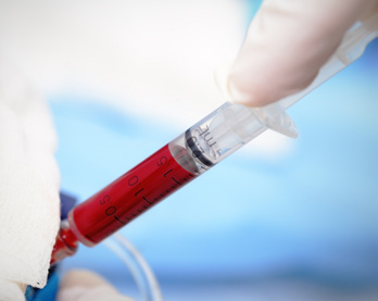 A syringe filled with plasma is seen in this stock image.