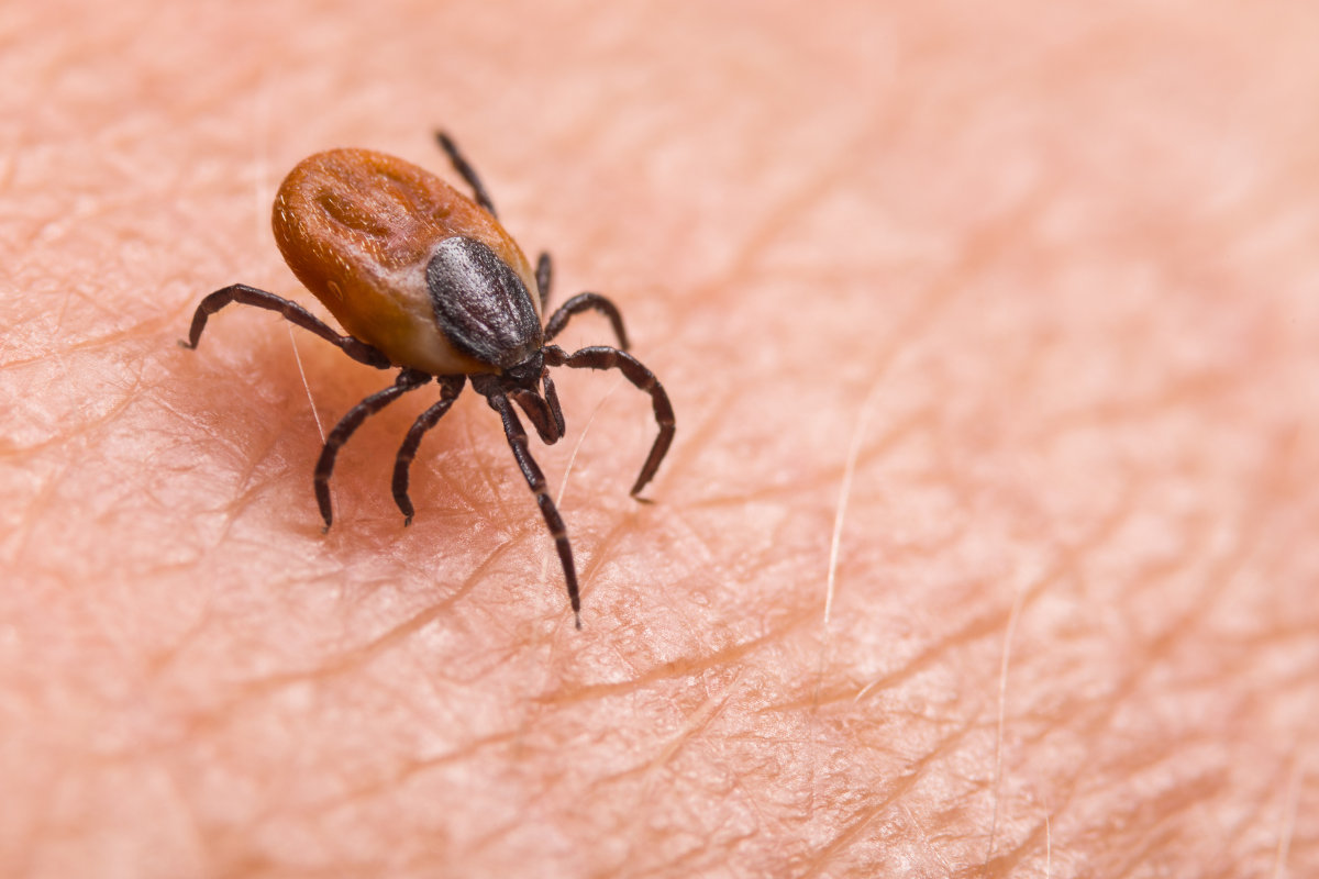 A close-up shot of a tick sitting on human skin.