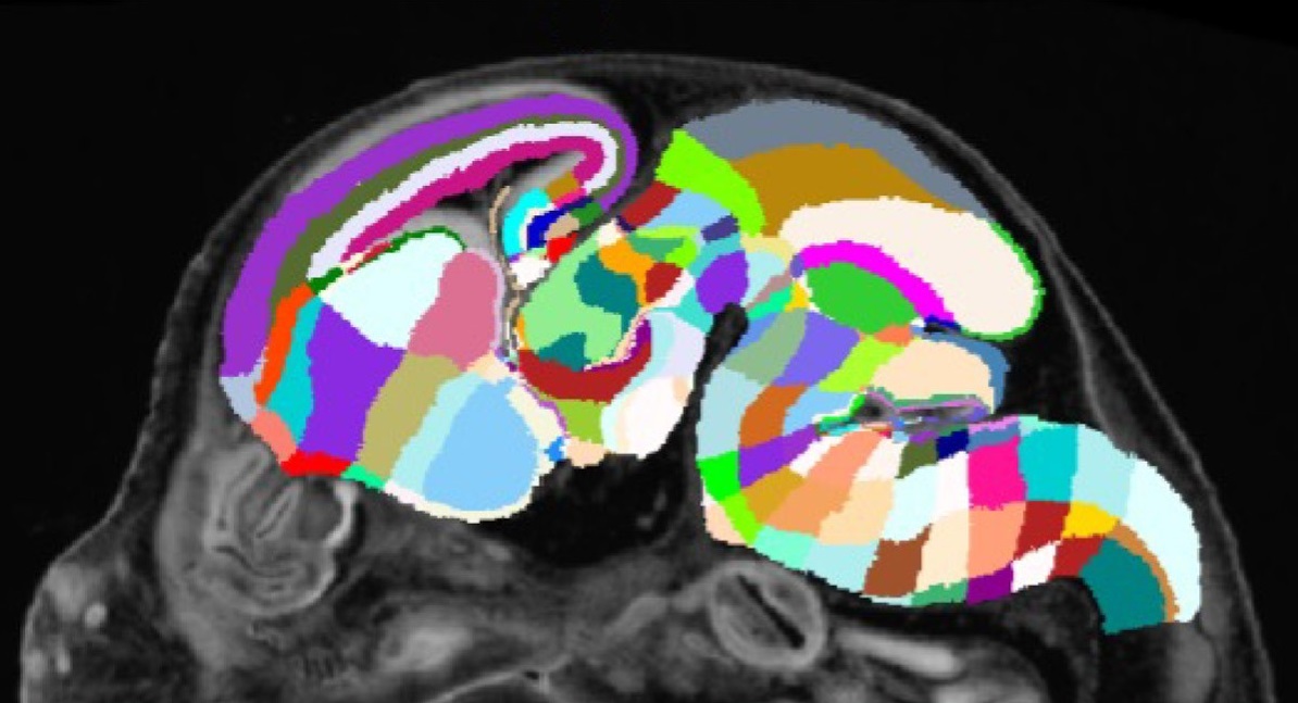 An image of a mouse brain has it’s different sections labeled using various colors.