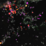 Red, purple and gray cells are present in a sample of a brain of MuPyV-infected mice. The red cells are CD4 T-cells and the purple cells are CD8 tissue-resident-memory cells.