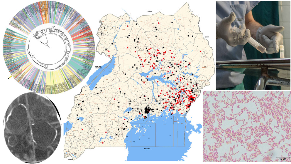 A collage image shows a map of Uganda, a DNA test, a brain scan and a photo of a person working in a lab.