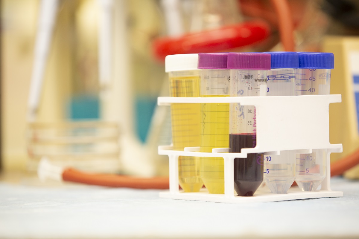 Glass tubes of lab specimens in box on a counter.