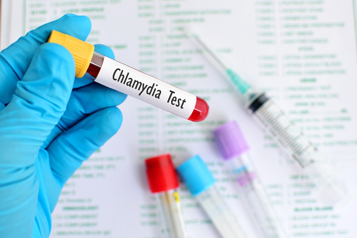 A gloved hand holds a test tube filled with blood that is labeled ‘Chlamydia Test.’