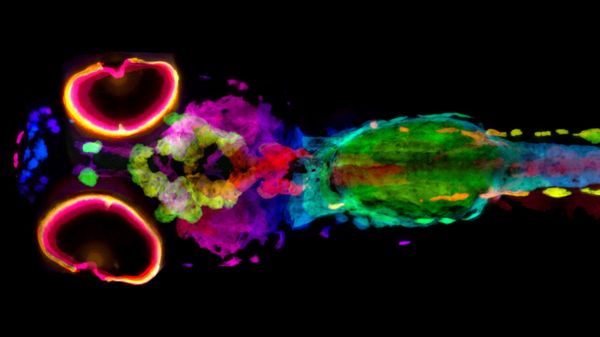 An image of a 5-day-old zebrafish with different colors throughout the zebrafish assigned based on the depth of the melanin in cells within the sample from top to bottom.