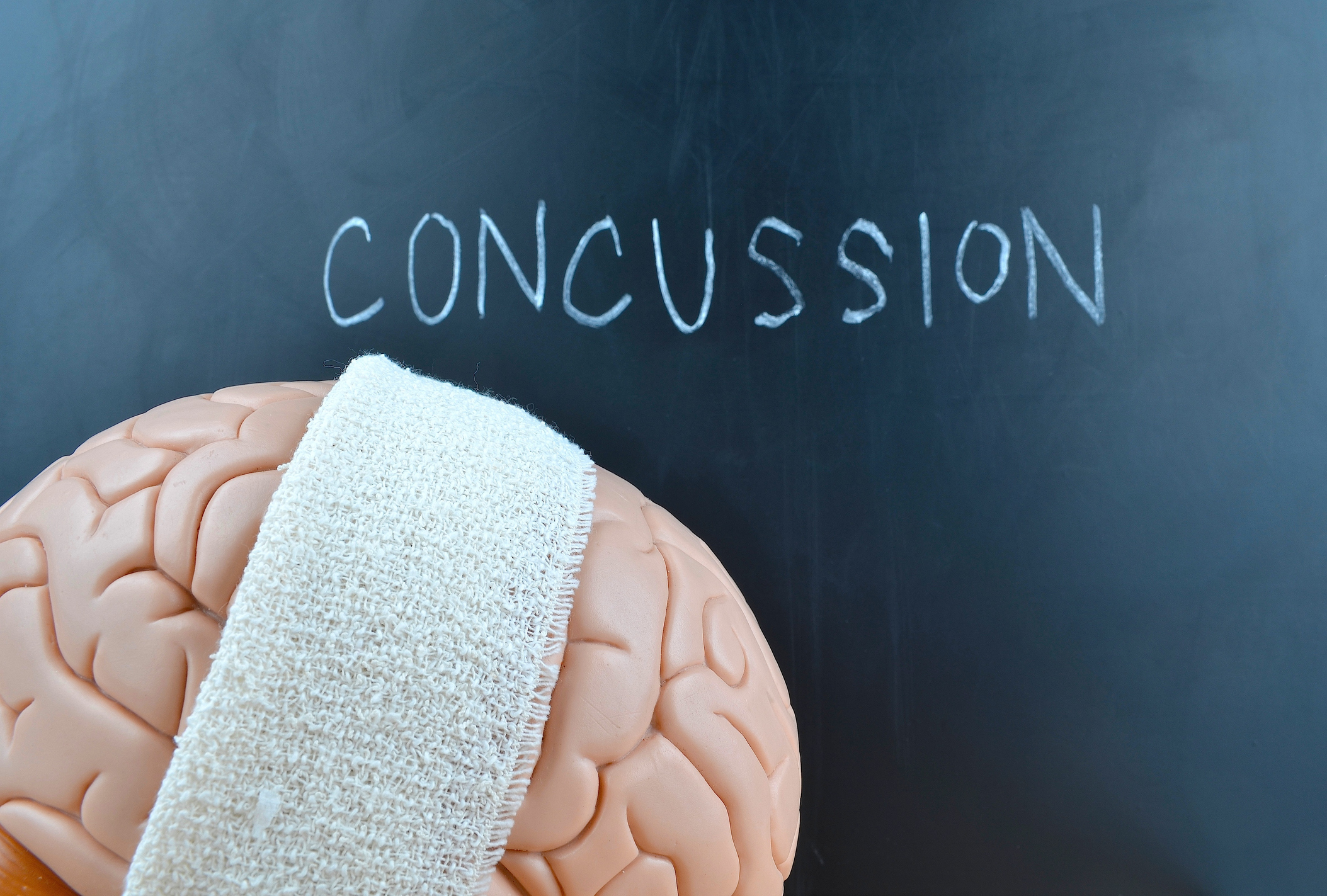 An illustration shows a brain draped with an athletic towel. Behind it on a chalkboard is written the word “concussion.”