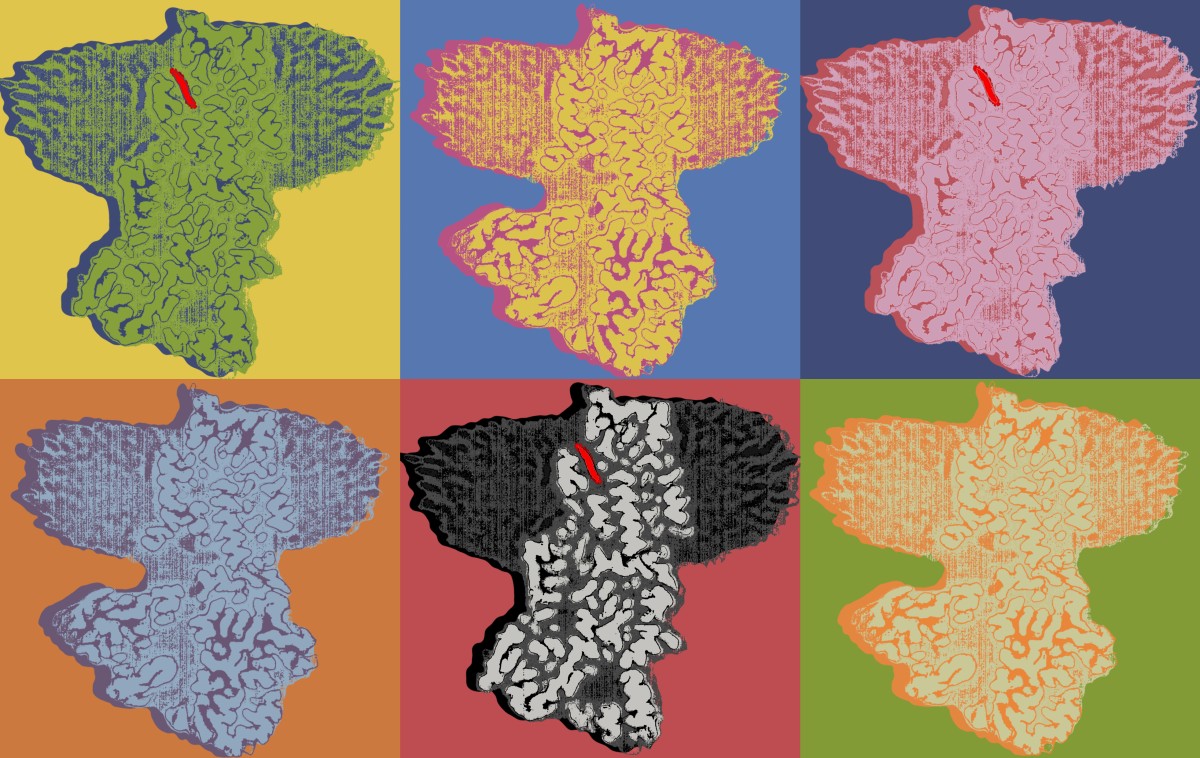 Illustrations of the ATP13A2 protein in six different color schemes. A handful of the illustrations show a narrow channel used for polyamine transport.