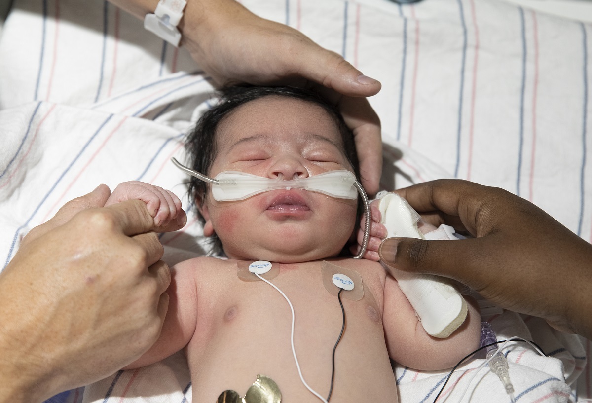 Newborn Aiden Shimp, who has a full head of hair, lies on striped sheets with his eyes closed and his parents’ hands cradling his head and holding each of his hands. He wears a canula in his nose and monitors on his chest.