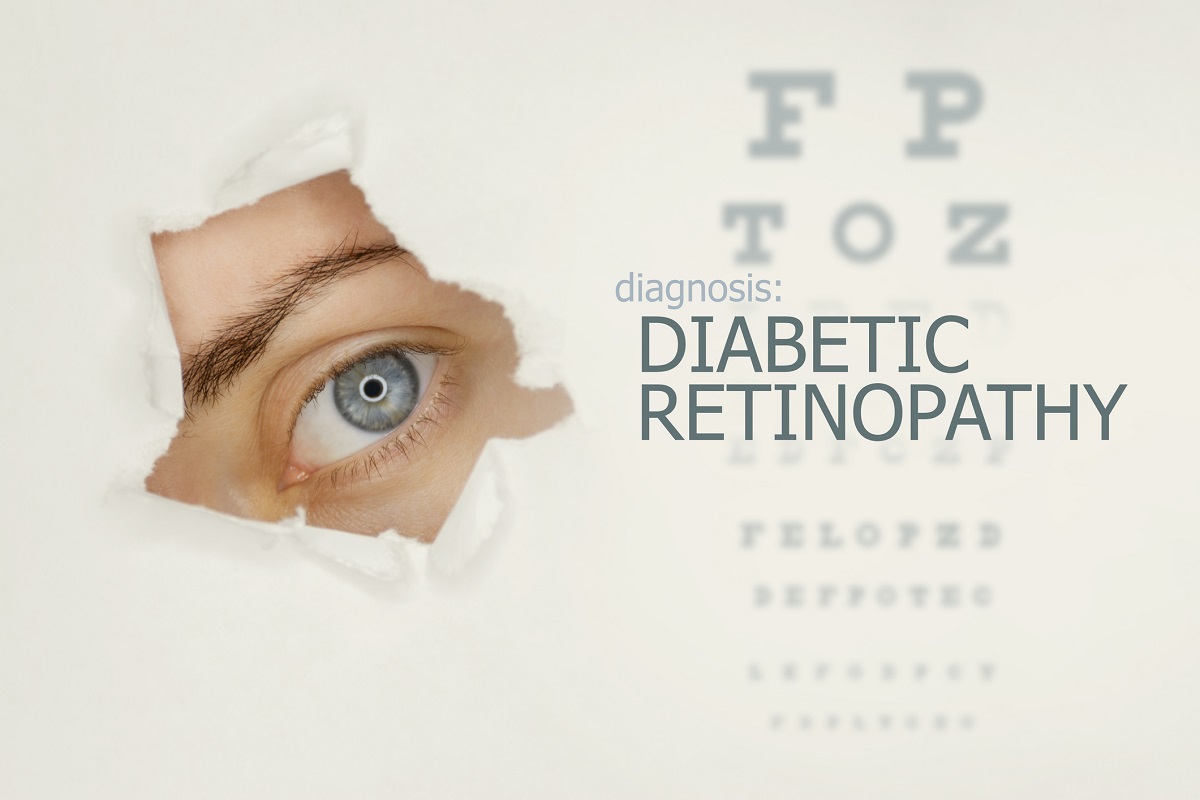 Woman’s eye looking through teared hole in paper, alongside an eye test with the words “Diabetic Retinopathy” on right.