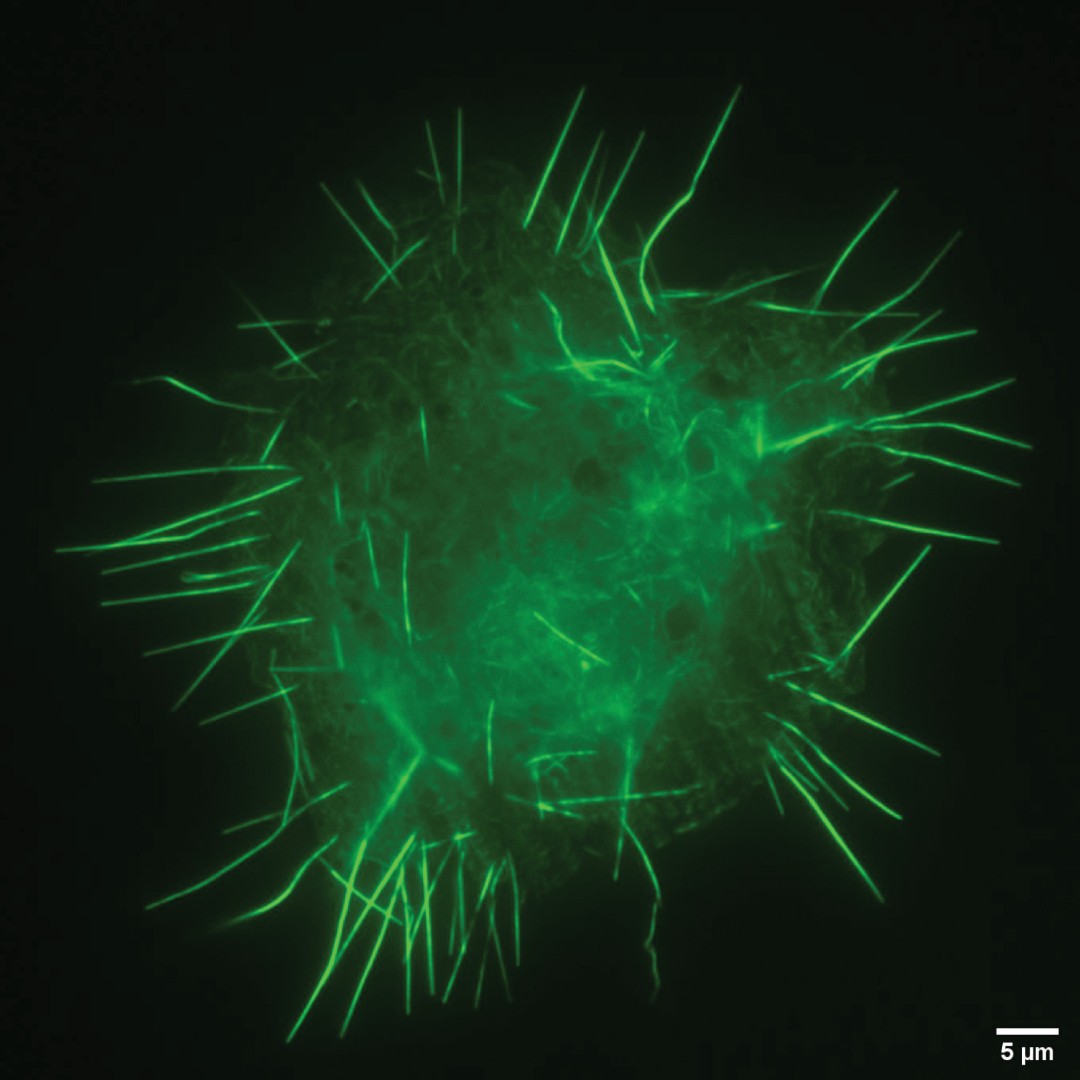 A microscope image showing class three myosins localizing to the tips of stereocilia, parts of the inner ear that are critical for hearing.