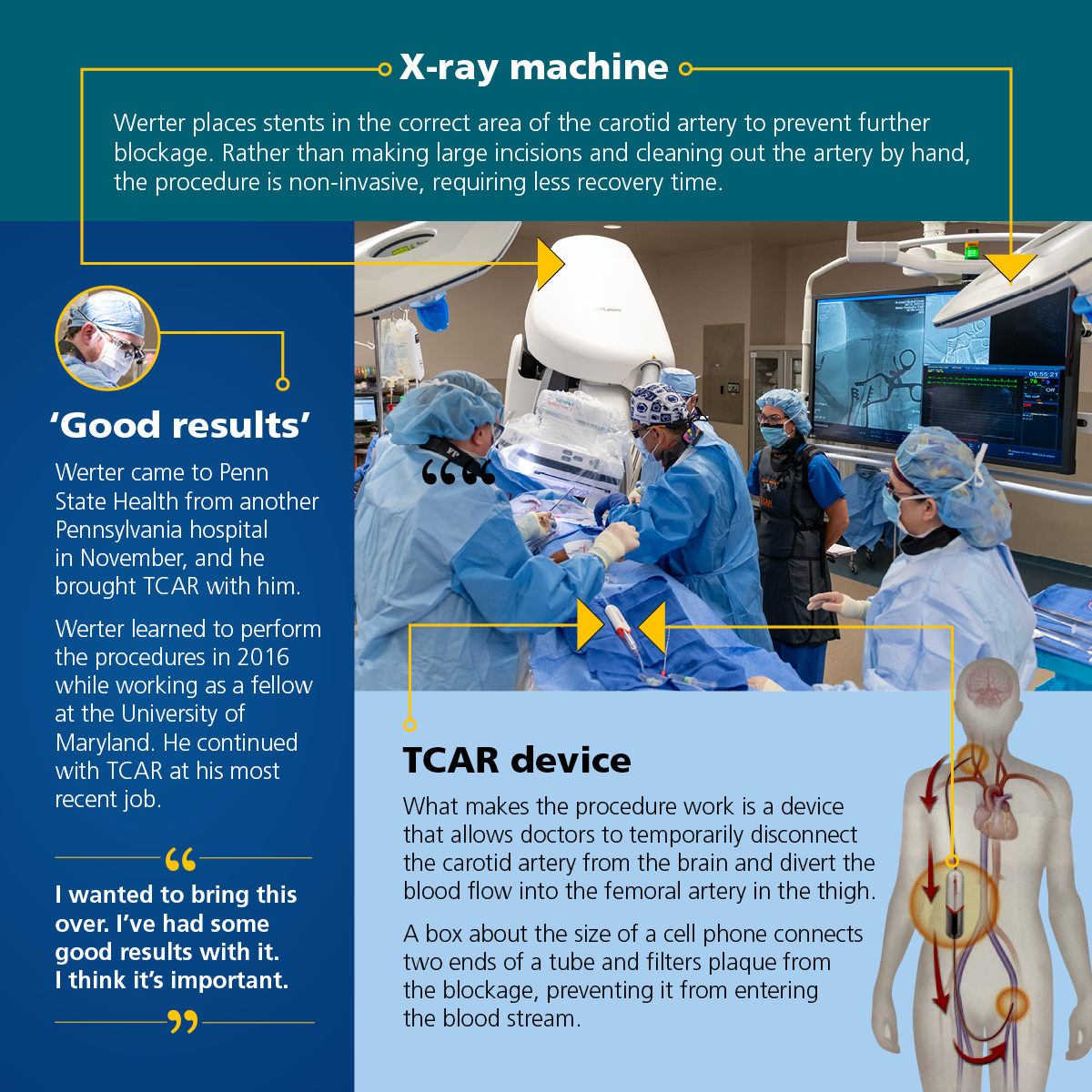 A graphic explains the TCAR procedure.
