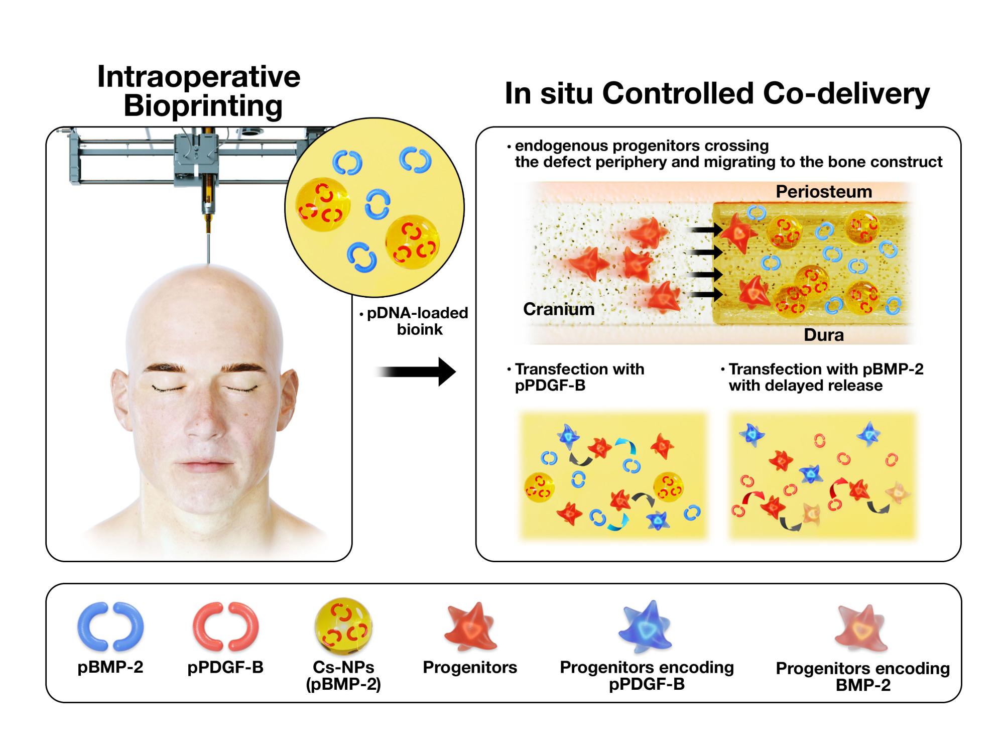 A graphic shows how intraoperative bioprinting can be used to improve bone repair.