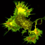 A whole, live cell image of a neuron expressing fluorescently tagged actin and cofilin.