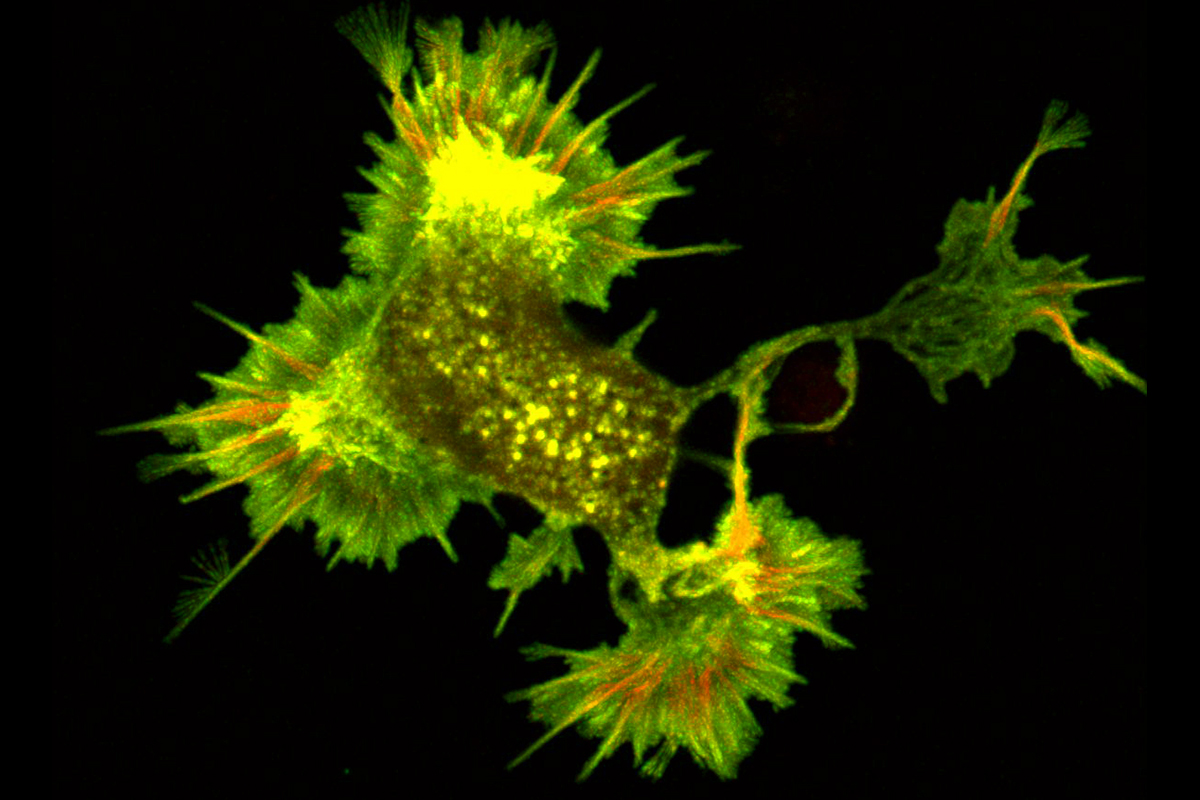 A whole, live cell image of a neuron expressing fluorescently tagged actin and cofilin.