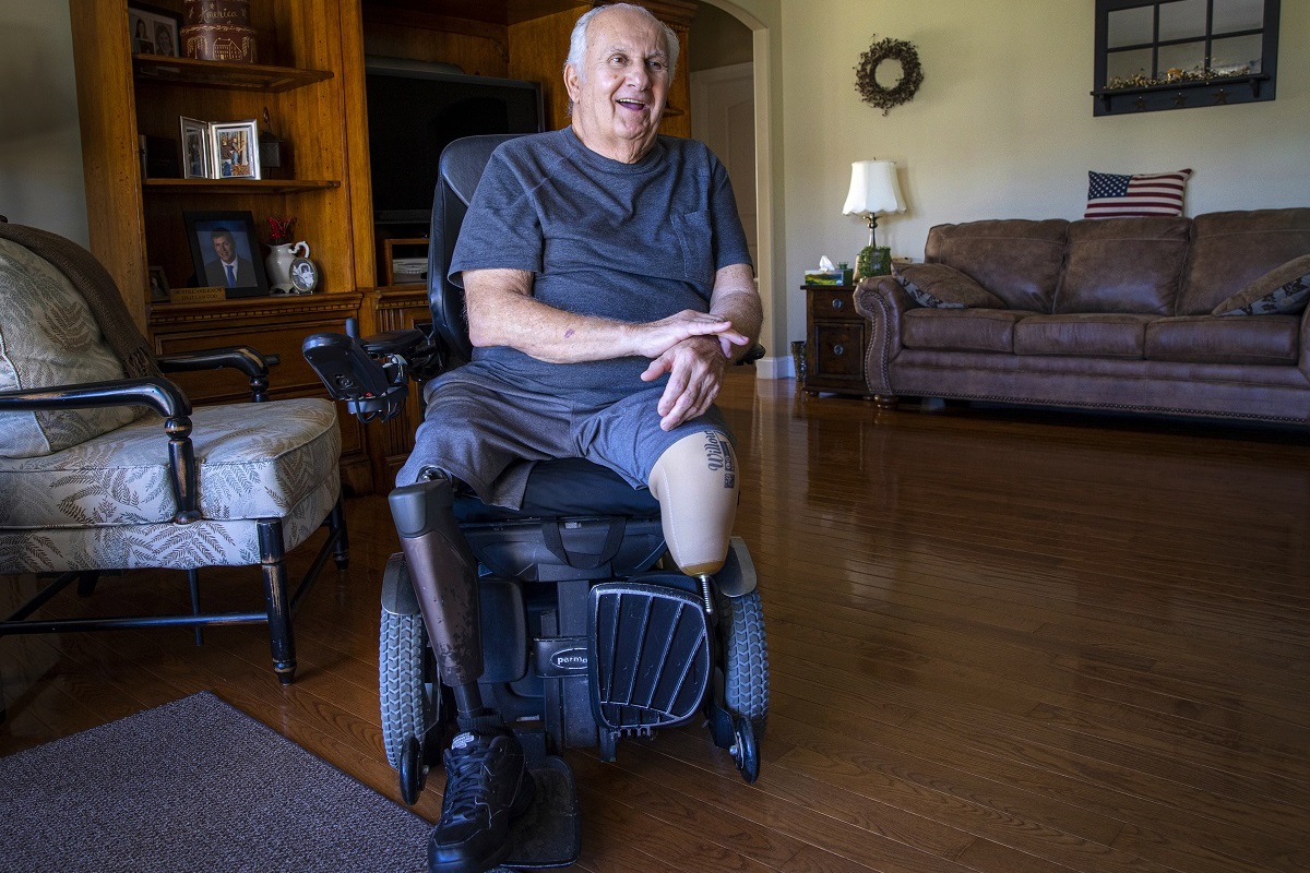 A man sits in a wheelchair a living room. His right leg is a prosthetic. His left is amputated near the knee. The man smiles and speaks.