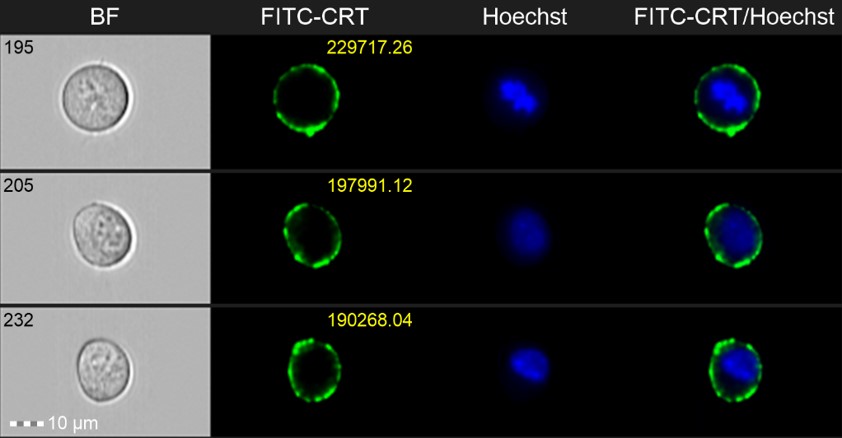 Twelve images of melanoma cells captured from an imaging cytometer are shown in a figure.