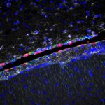 Immunofluorescence microscopy reveals glial cells of a mouse brain infected with mouse polyomavirus.