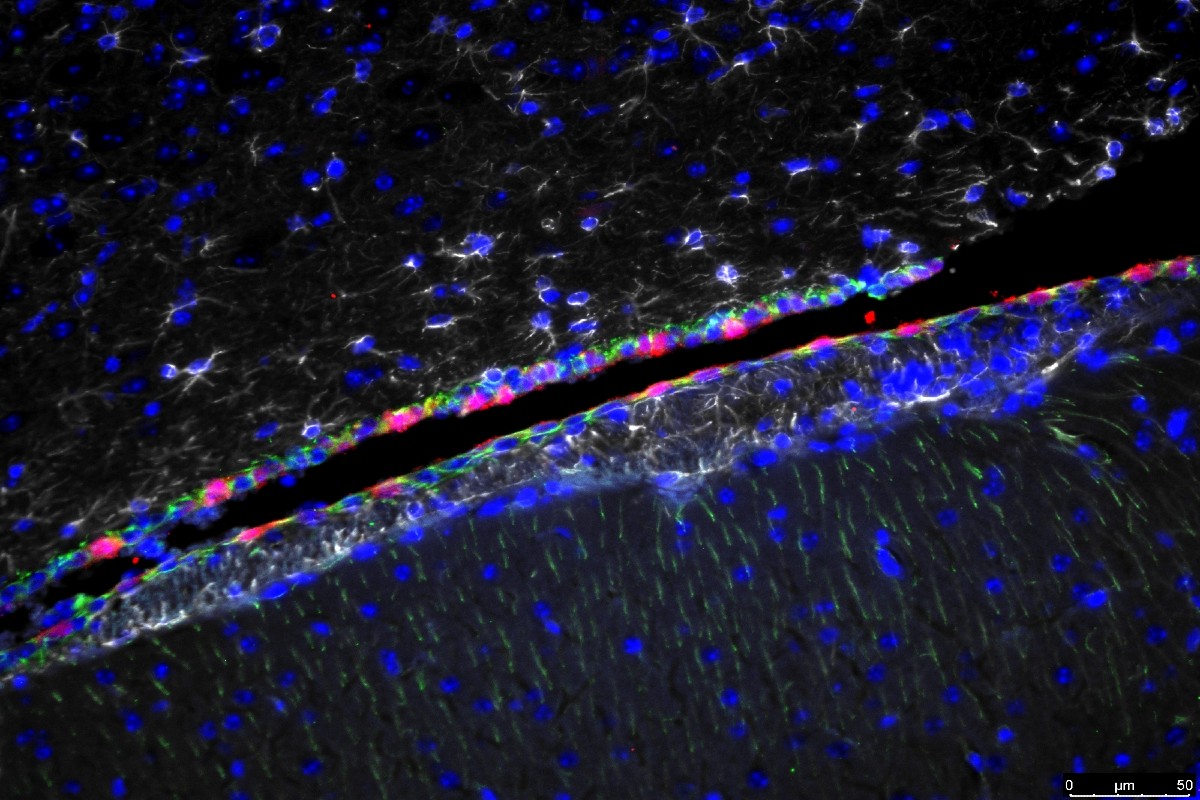 Immunofluorescence microscopy reveals glial cells of a mouse brain infected with mouse polyomavirus.