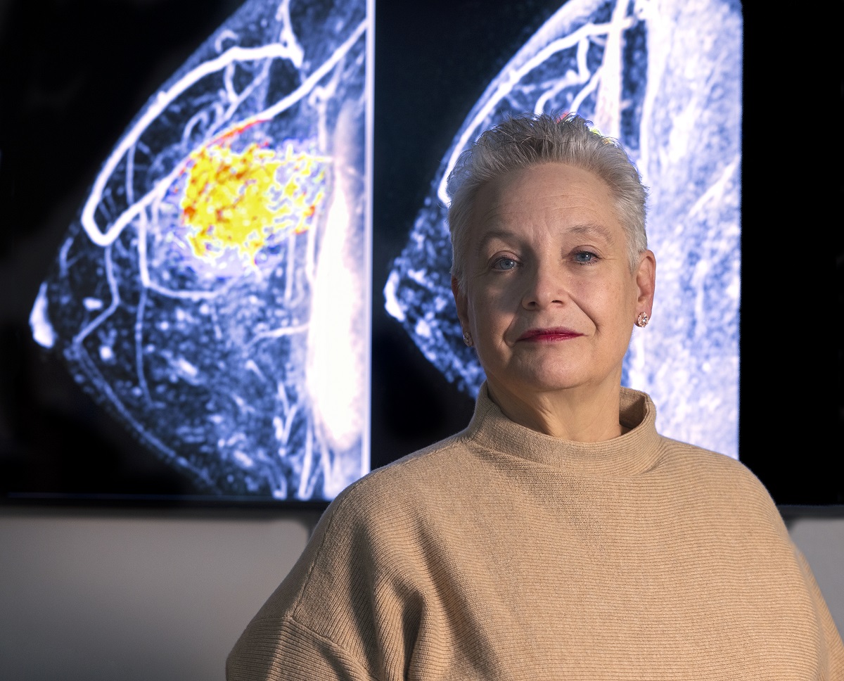 Doris Shank stands in front of x-ray images of a breast.