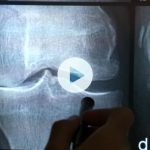 An x-ray with a play button overlay