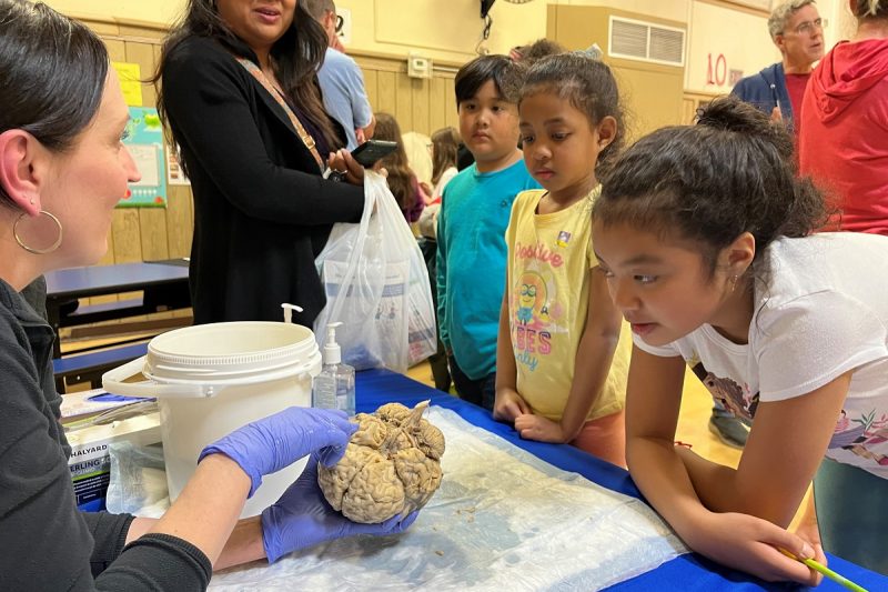 A group of children huddle around a woman pointing to a disembodied human brain.