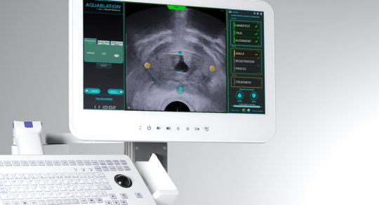 Penn State Health offers innovative Aquablation therapy to treat enlarged prostate