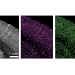 A photo shows images of brains