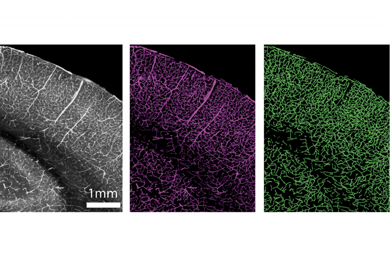 A photo shows images of brains