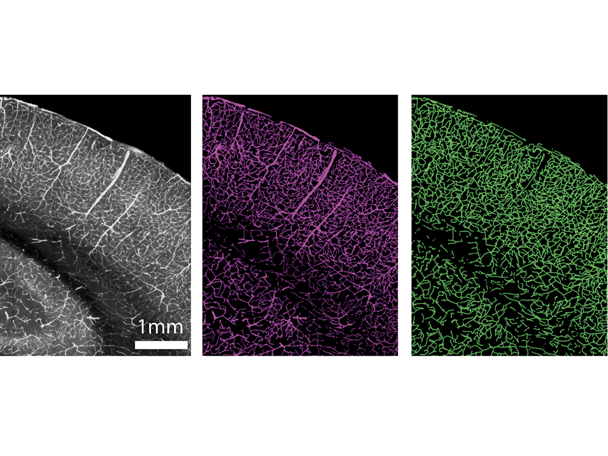 A photo shows images of brains