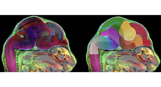 Researchers develop 3D atlas of the developing mammalian brain
