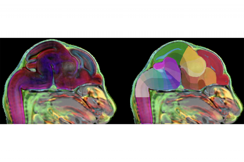 An image of a mouse brain