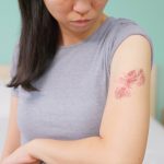 A young woman looks down at shingles rashes on her left arm. A bed and nightstand are in the background, slightly out of focus.